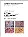 Atlas of Liver Pathology